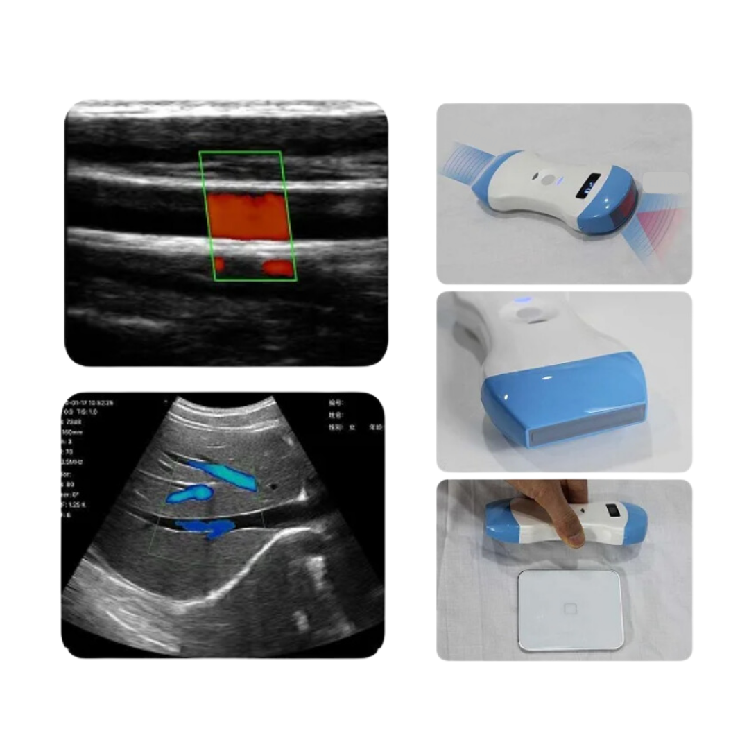 Ultrasonido Wireless Color Doppler Transductor Convexo y Lineal